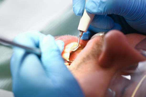 Best Dentist Open Late Near Me  in Fairplay, GA